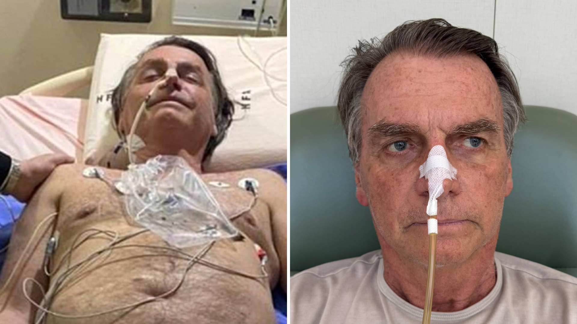 Bolsonaro diagnosticado com cancro de pele